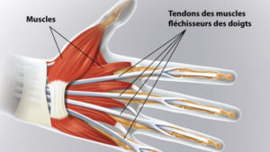 Section tendineuse